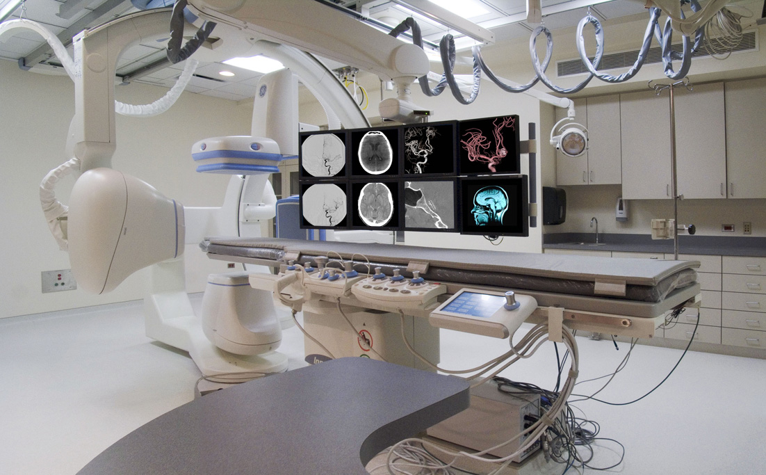 RMC. Neuro-Biplane for Interventional Radiology Remodeling